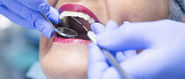 Best Emergency Tooth Extraction in Copperopolis, CA