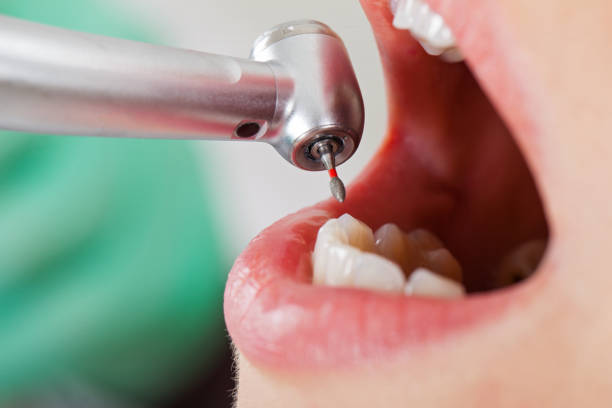 Best Emergency Gum Treatment in Copperopolis, CA